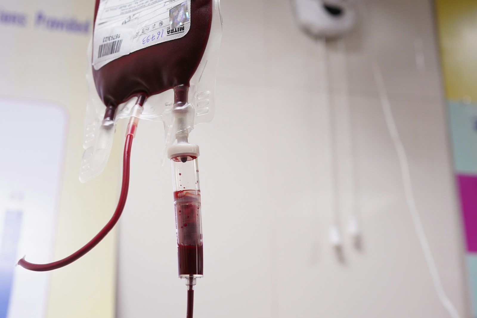 Blood bag hanging in a clinical setting, illustrating blood donation